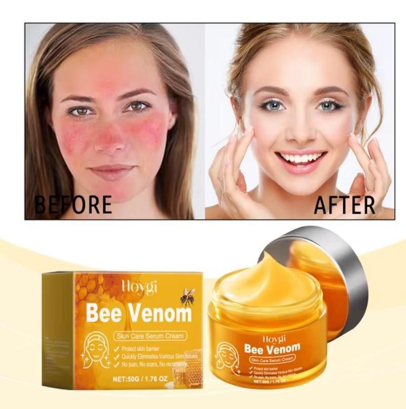 VenoLift Bee Venom Spray