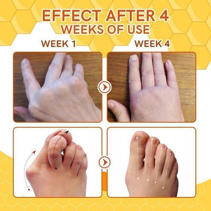 VenoRelief Bee Venom Spray – (Pack of 3)